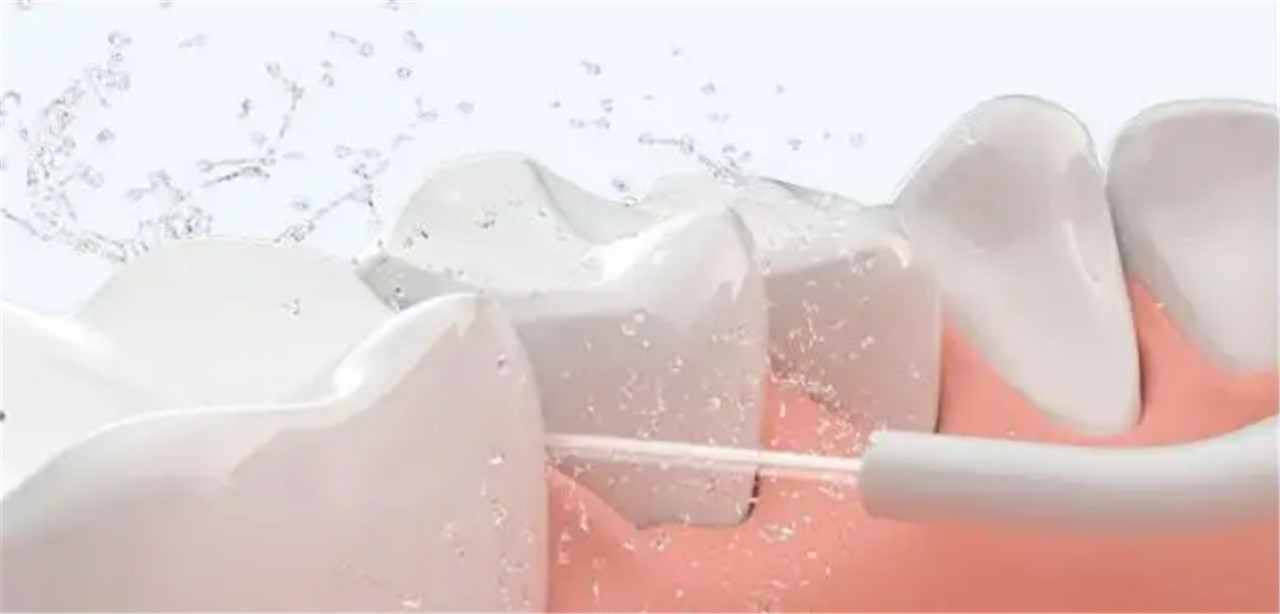 Nytt produkt av dental flosser mini bærbar munnskylling (1)